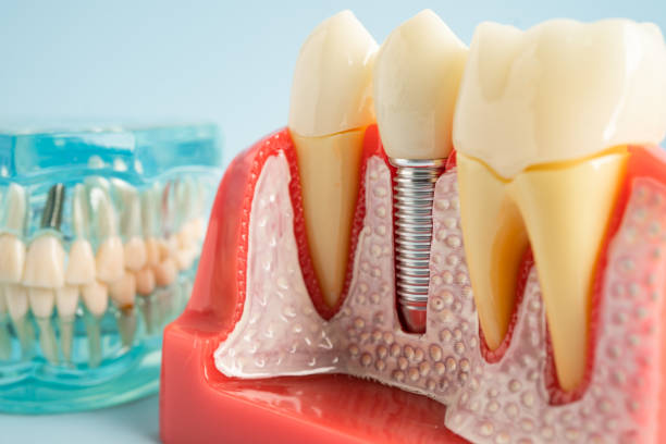 Best General Dentistry  in North Sioux City, SD